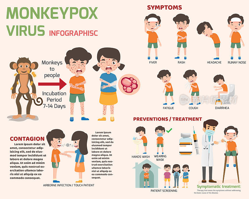 猴痘病毒信息图元素，人体有皮疹。疾病症状:淋巴结肿大，肌肉疼痛，发烧，头痛，皮疹。矢量插图。