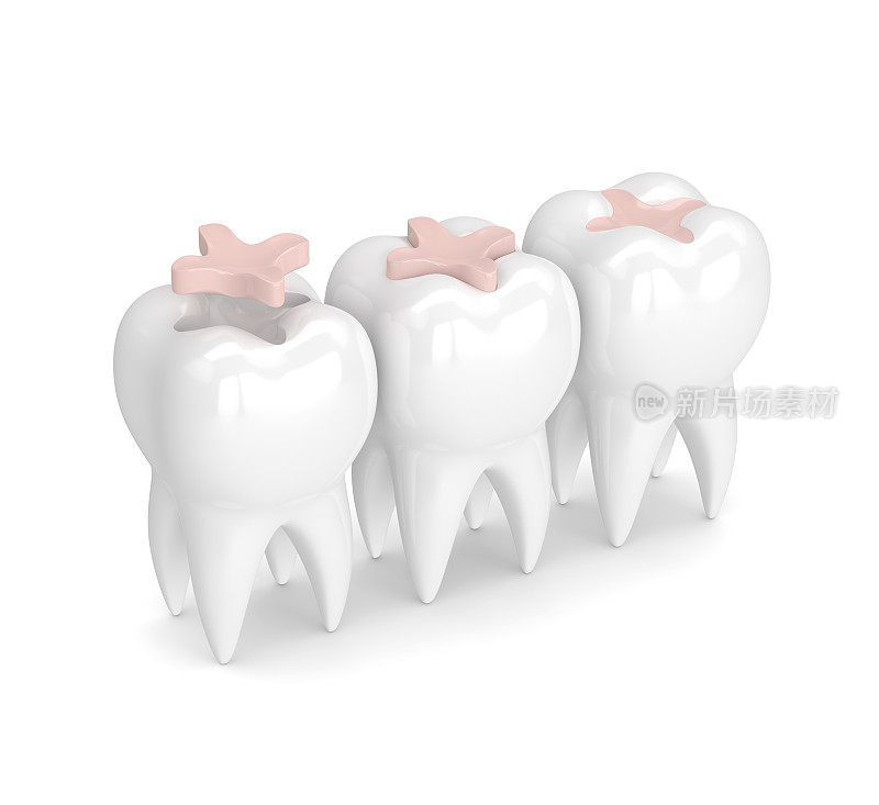 牙齿的3d渲染与牙齿镶嵌填充