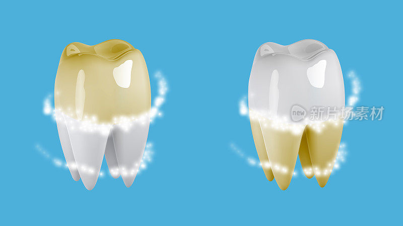 三维牙齿美白卫生图标。用激光清洗牙菌斑，牙膏，保护龋齿，光泽灿烂笑容，呵护牙釉质。