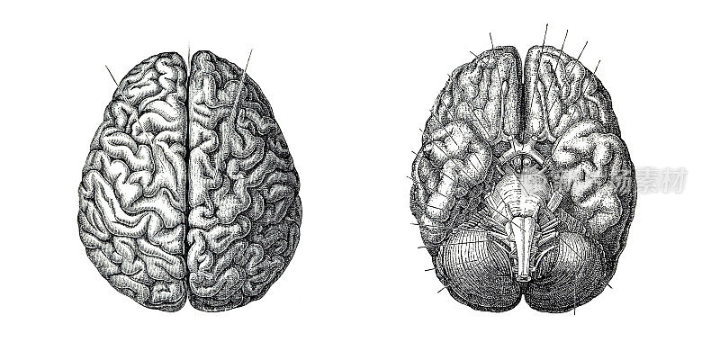雕刻人脑1883年