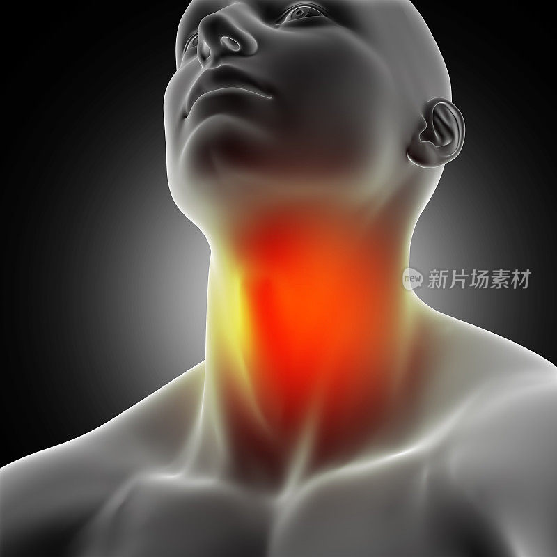 喉咙痛的3D男性医疗形象