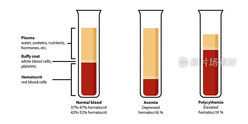 血液成分:正常、贫血、红血球增多