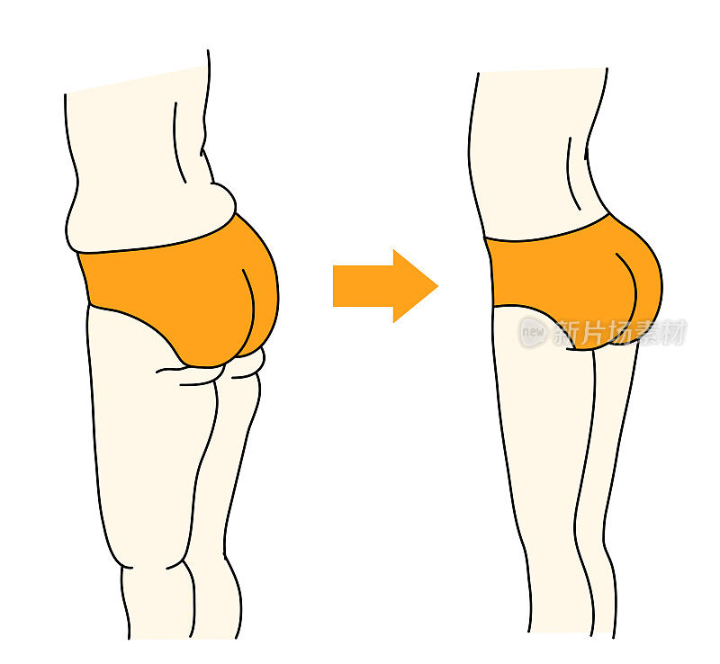 这是腹部、腰部、臀部和腿部塑形前后的对比图。