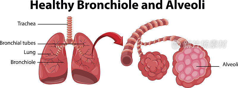 图显示健康的细支气管和肺泡