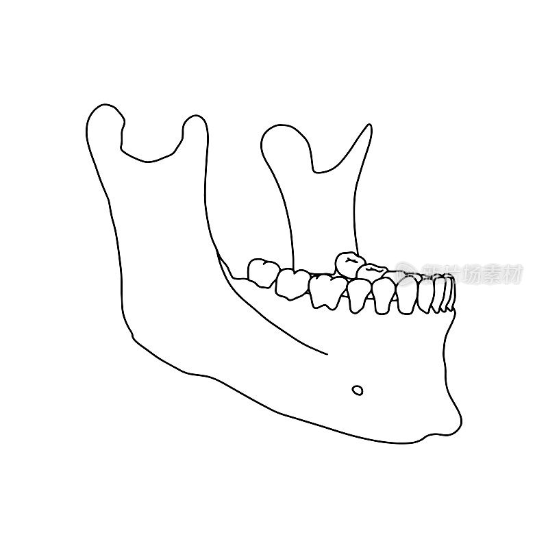 人类下颌和牙齿，侧面图。