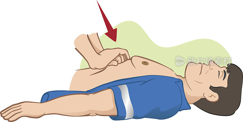 急救复苏(CPR)，腹部按压按摩