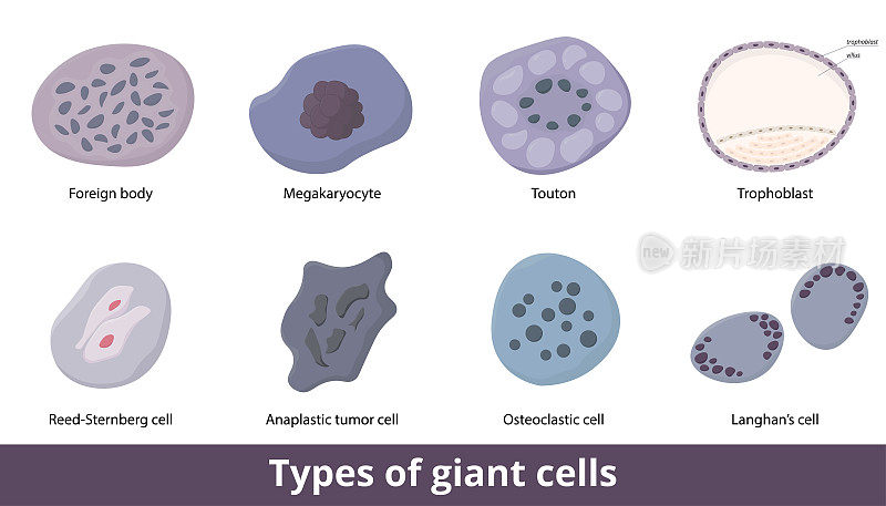 巨细胞的类型
