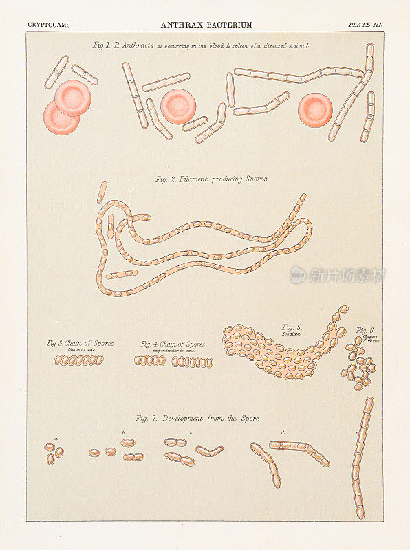炭疽菌色版印刷术1883年