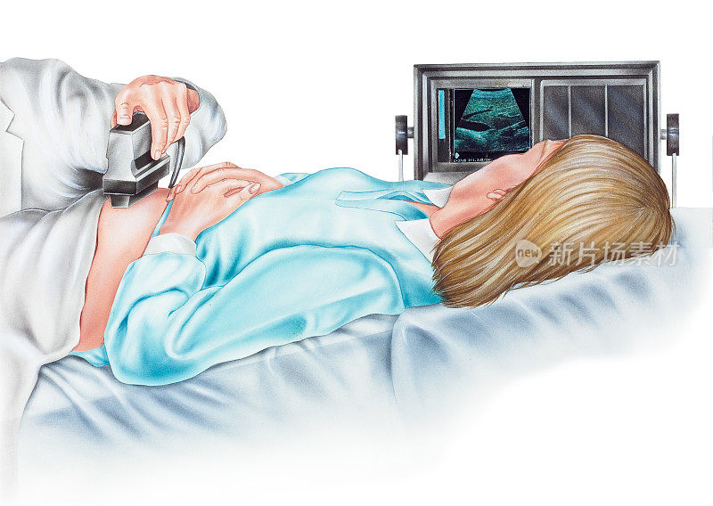 怀孕-孕妇的超声图
