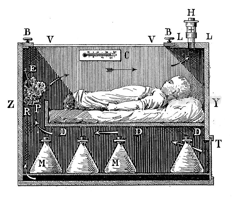 古董插图:婴儿孵化器