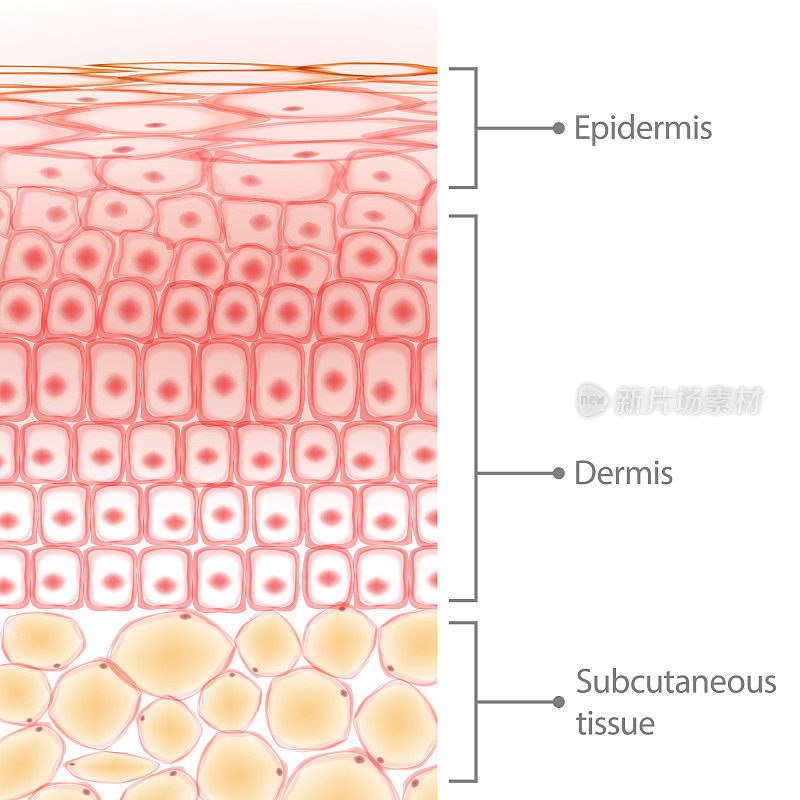 皮肤组织层，皮肤细胞和脂肪组织细胞，真皮层和脂肪细胞