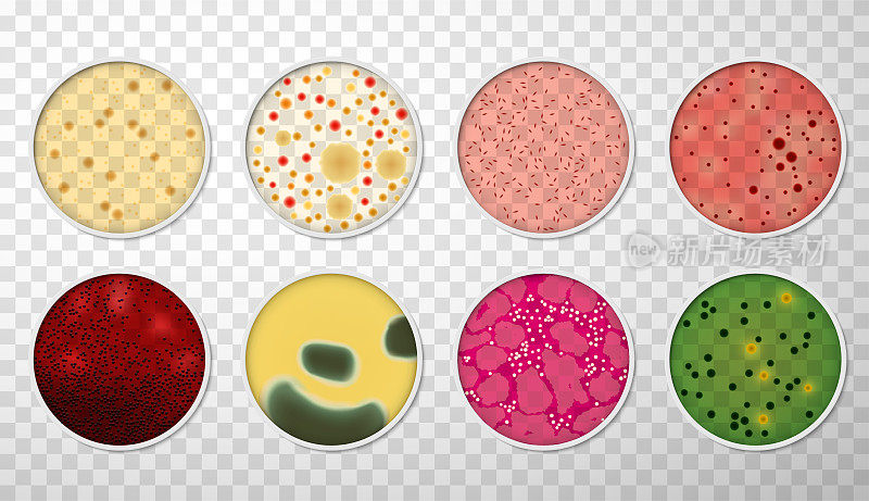 培养皿与细菌和细菌菌落设置顶视图现实的载体微生物细胞