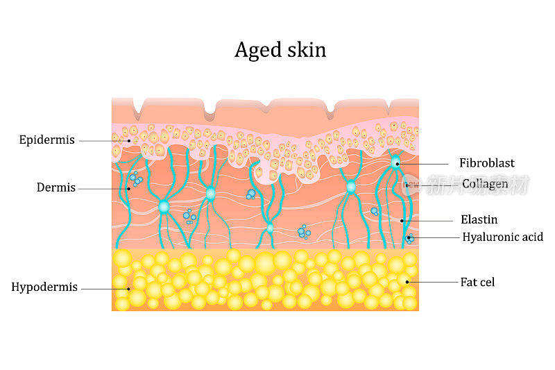 岁的皮肤层。人体皮肤结构有胶原蛋白和弹性纤维，透明质酸，成纤维细胞。示意图说明。矢量图