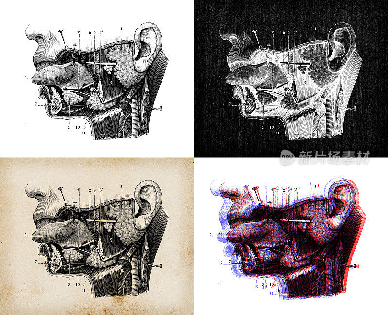 古董插图:头喉段