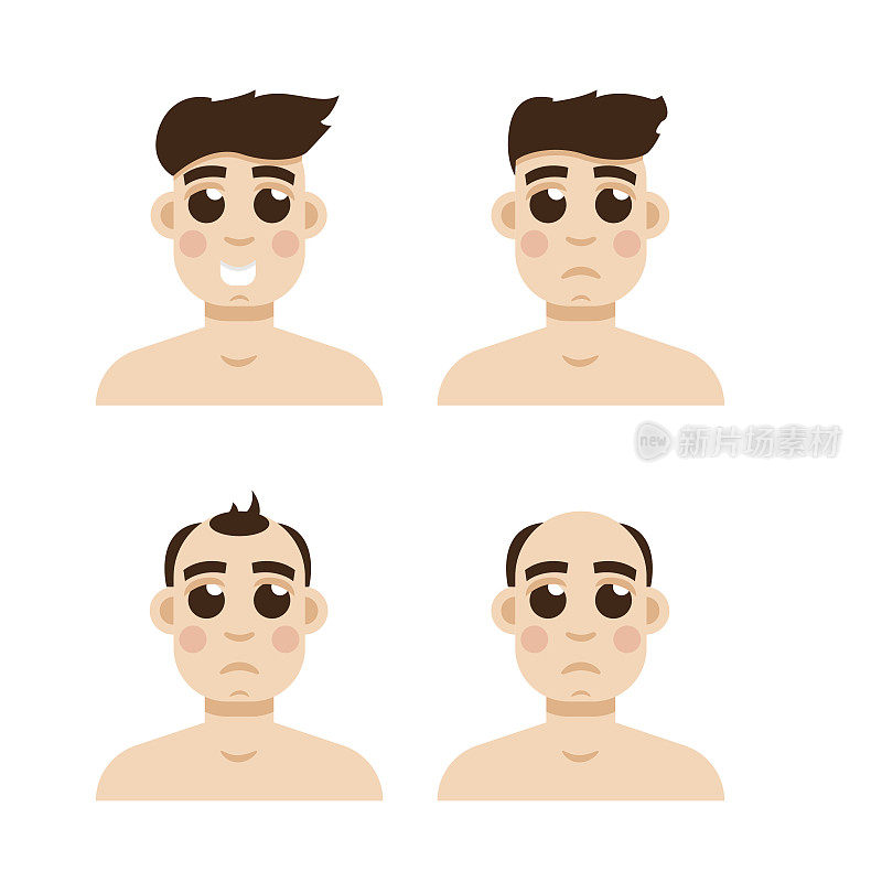 发阶段损失。男性头部秃顶向量的类型。