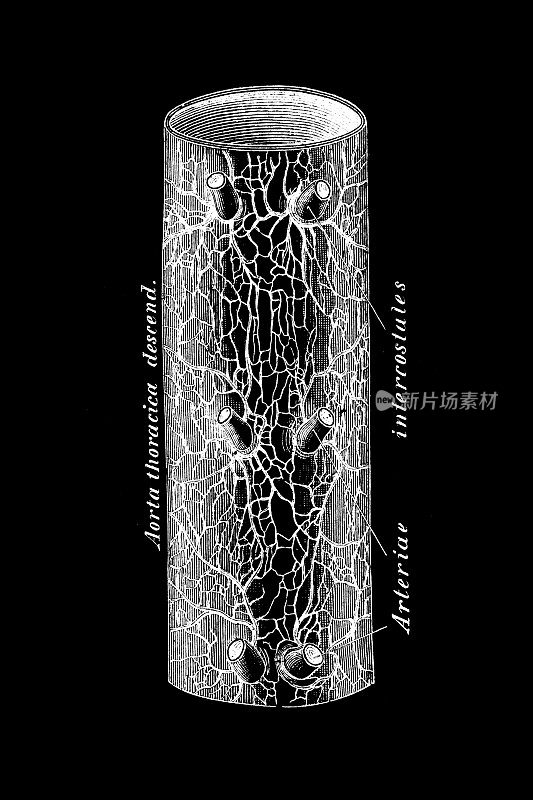 胸主动脉