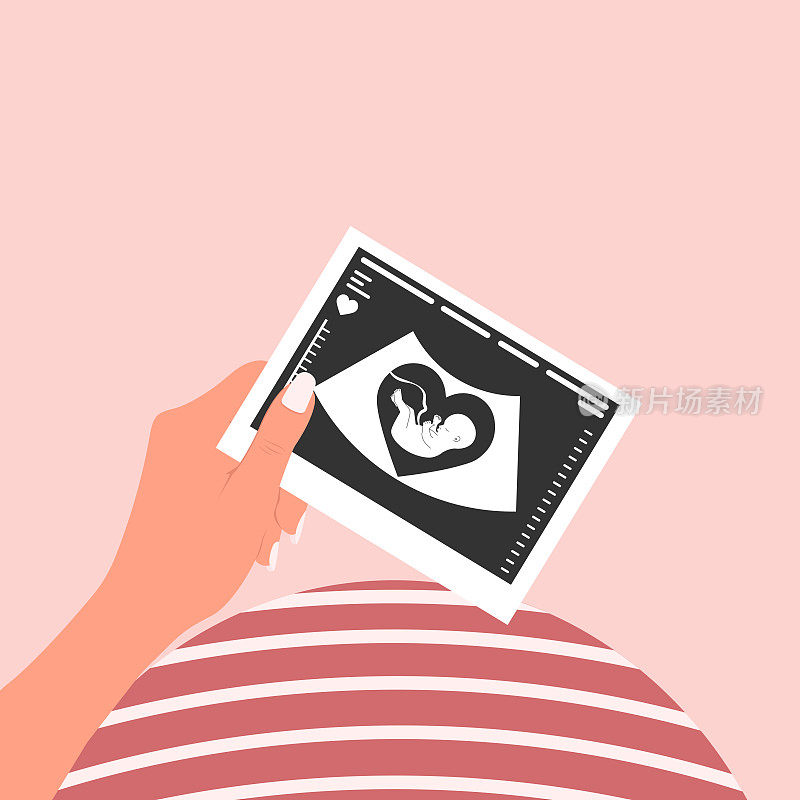 一个快乐的孕妇拿着一张胎儿的超声波扫描图。婴儿的超声波图像。向量
