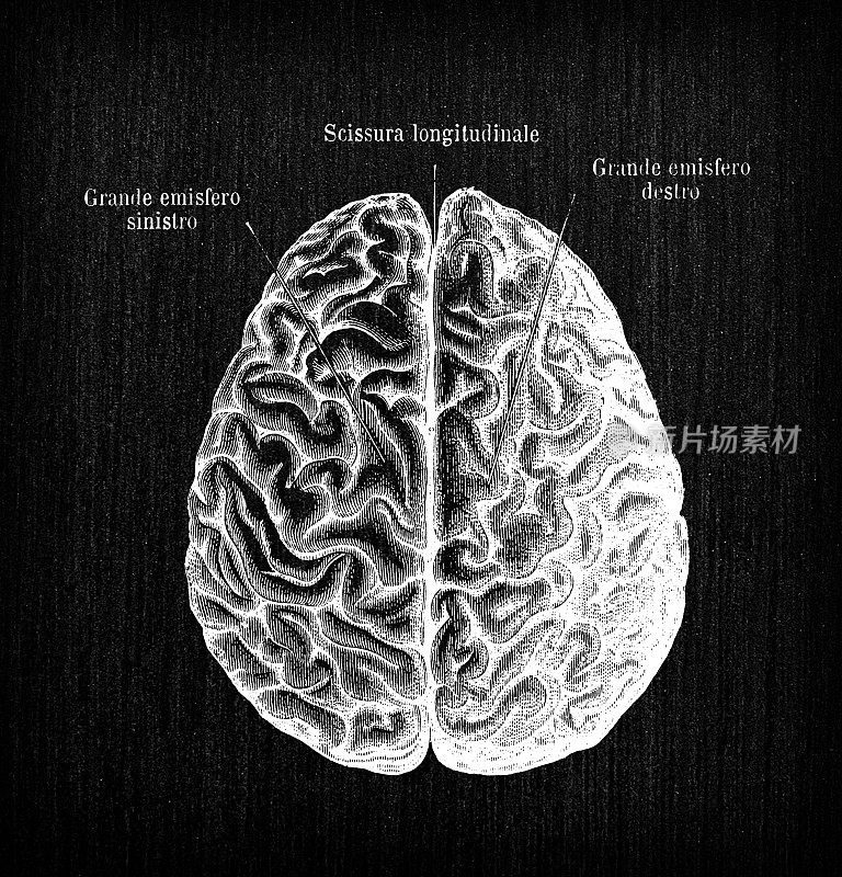 人体解剖学古董插图:大脑