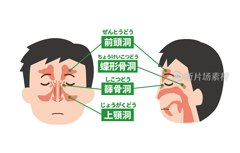 鼻子前部和侧面的内部图像2