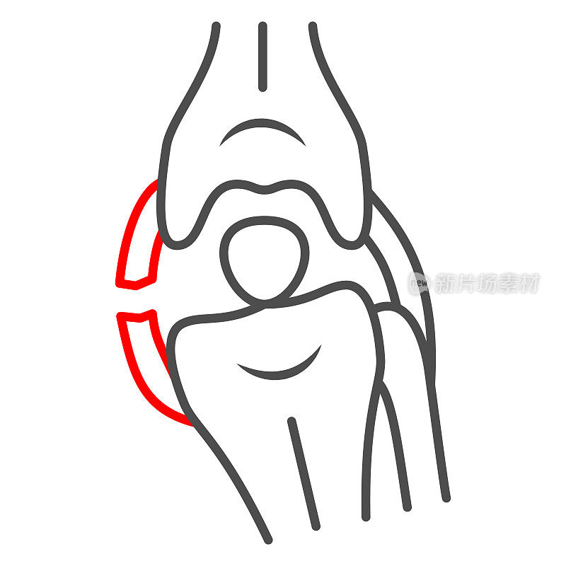 外侧膝盖韧带断裂细线图标，人类疾病的概念，膝盖问题的标志在白色背景，骨创伤图标轮廓风格的移动概念和网页设计。矢量图形。