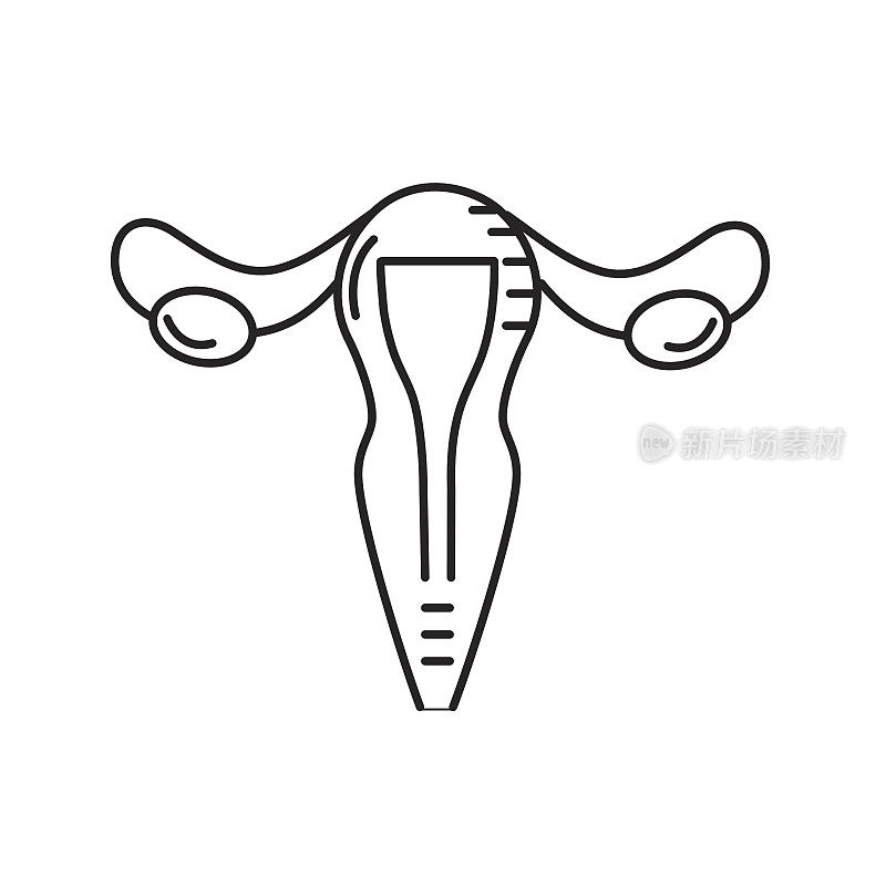 子宫线输卵管解剖女性