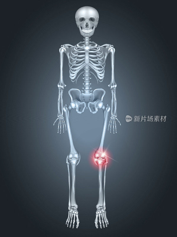 骨骼有膝关节疼痛