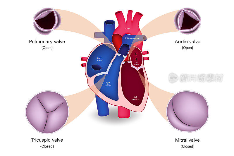 人体心脏瓣膜解剖。收缩。肺动脉瓣，主动脉瓣，三尖瓣，二尖瓣。
