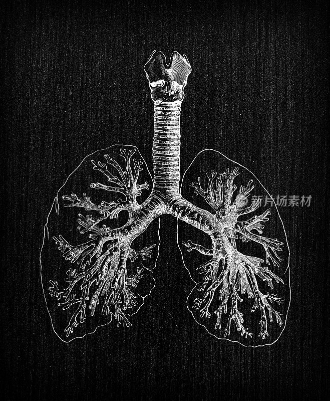 人体解剖学古董插图:支气管树和肺