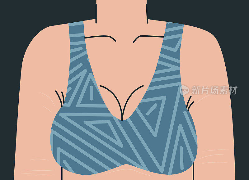 大女性胸围胸罩。女人的身体手臂和胸部都有妊娠纹。女性上身几何印花上衣。矢量趋势插图设计。
