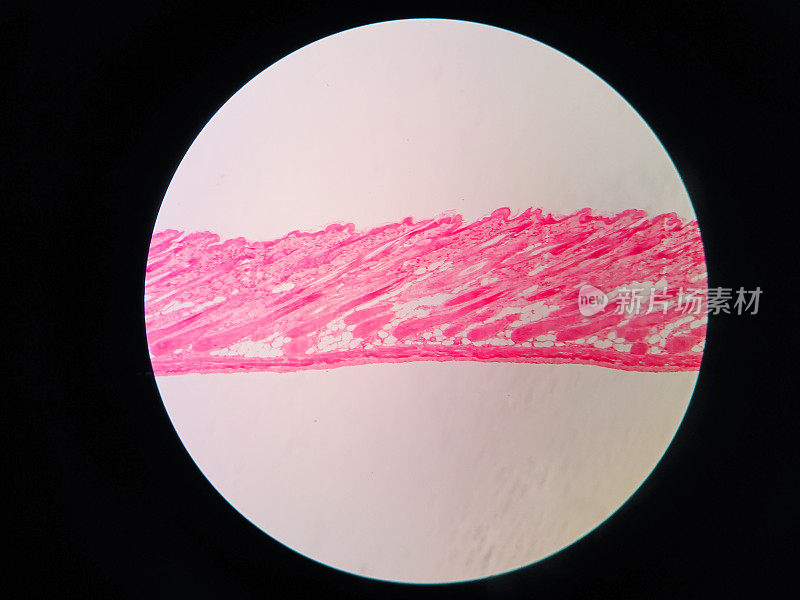 显微镜下人体皮肤组织横切面