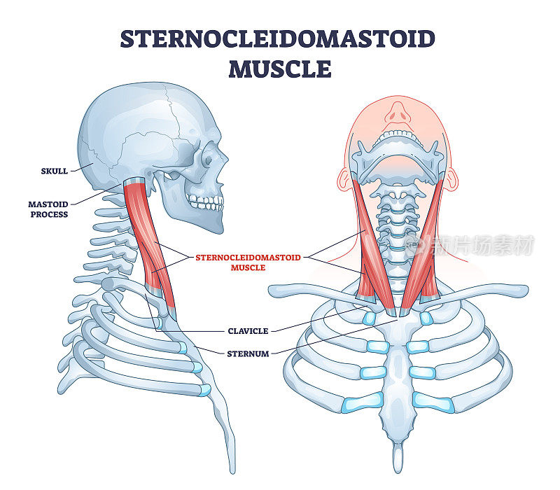胸锁乳突肌作为人体颈部肌肉系统的轮廓图