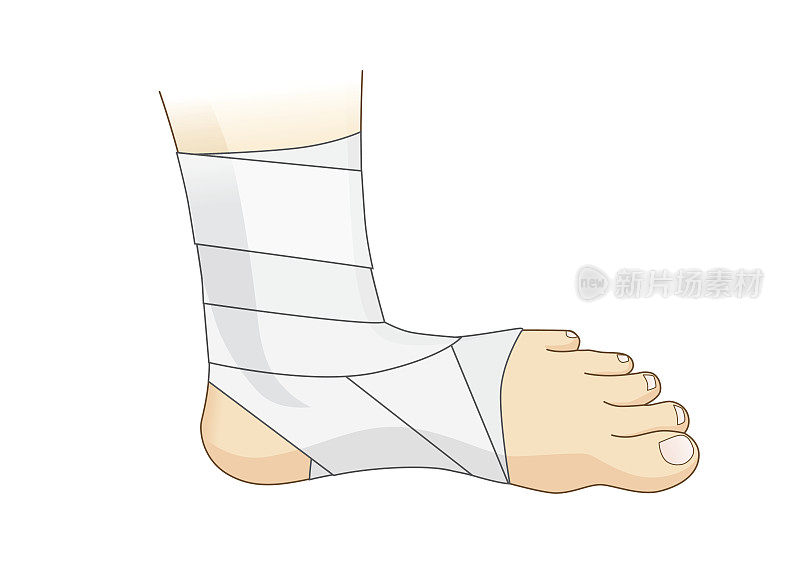 脚踝和脚用白色弹性绷带包扎。