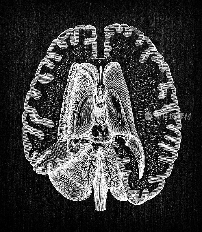 人体神经系统解剖古插图:脑切片