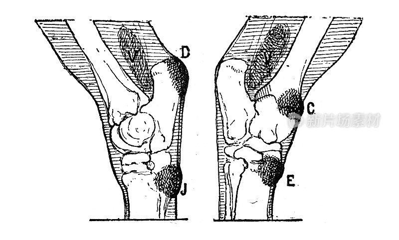 古董插图:马膝部缺损