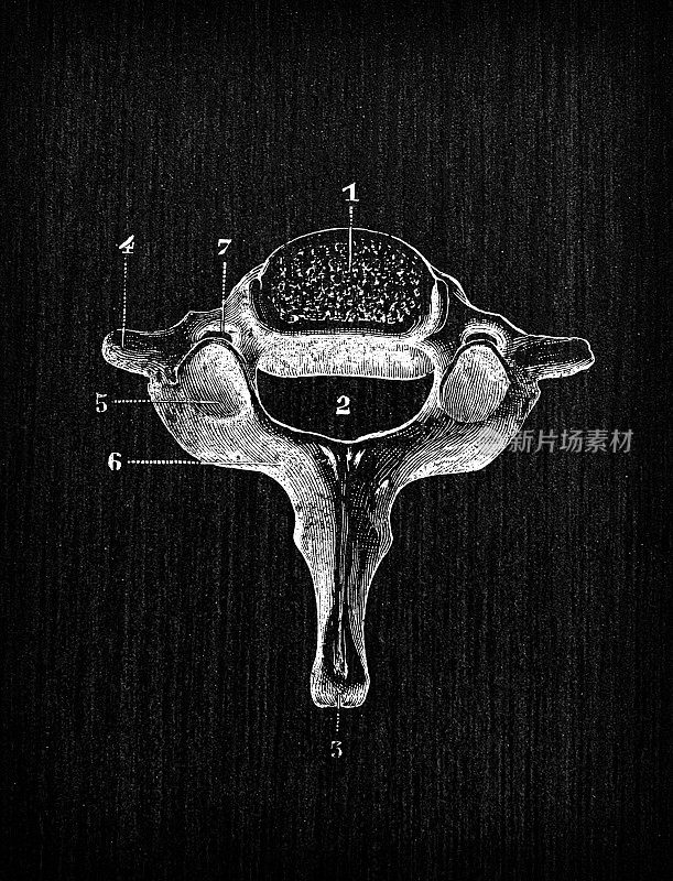 人体解剖骨骼古玩插图:第七颈椎