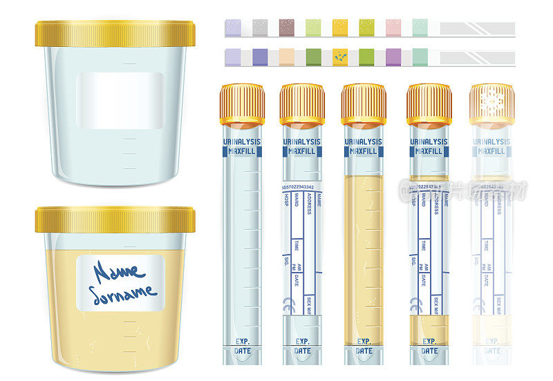 尿液分析用黄盖管套装，空，满，冷冻和浸渍