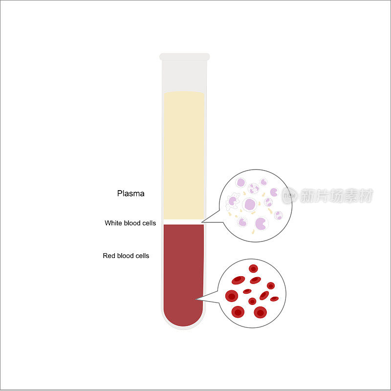 试管内的外周血或全血标本分为3层:血浆、白细胞(白细胞)和红细胞(红细胞)