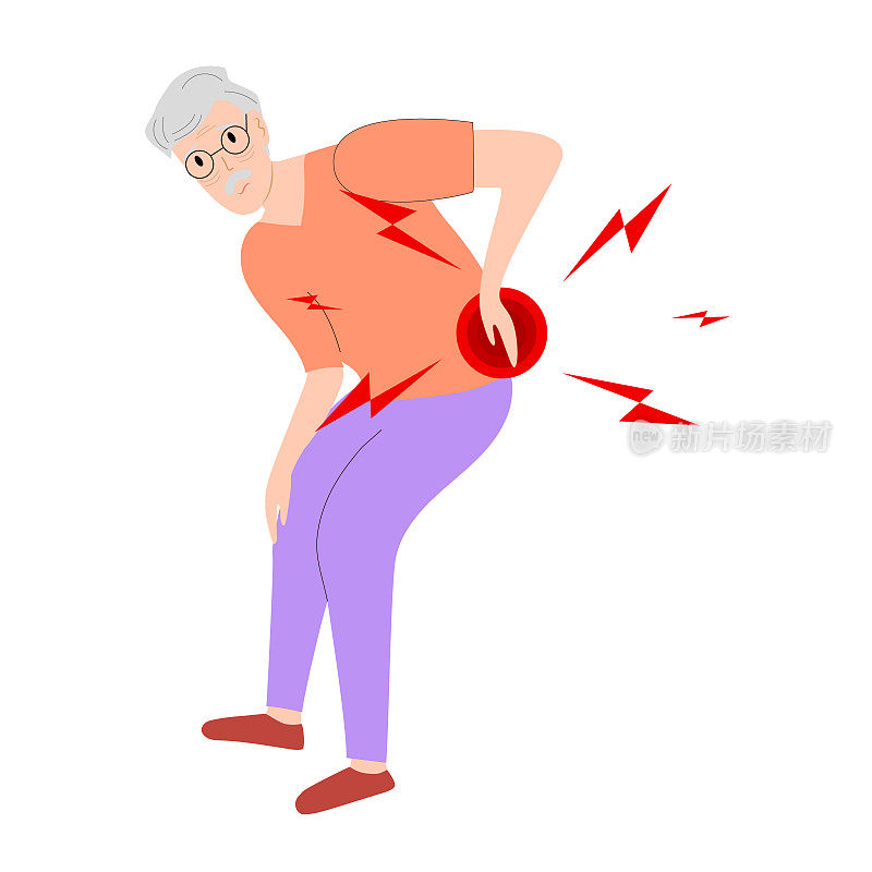 老年男子有腰痛和坐骨神经痛由椎间盘突出。医学上关于神经阻滞的图解使病人慢性背痛和瘫痪。矢量插图。