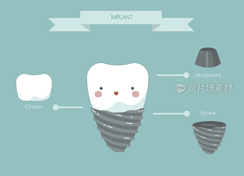 牙种植体的结构、牙体和牙体的概念