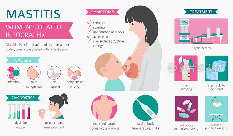 乳腺炎，母乳喂养，医疗信息图。诊断、症状、治疗。女性健康图标集