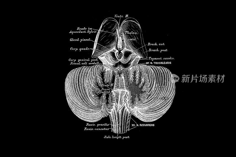 脑室大脑的第三和第四腔