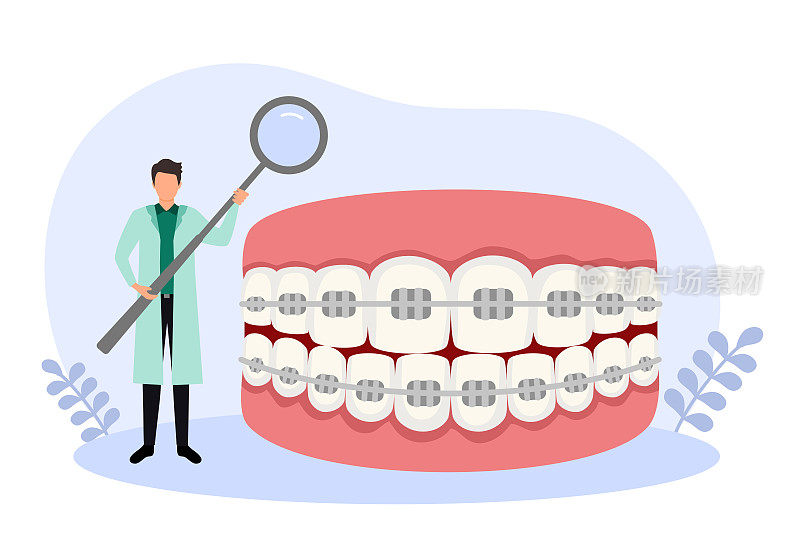 正畸概念矢量插图。白色背景上有牙医平面设计的牙套。