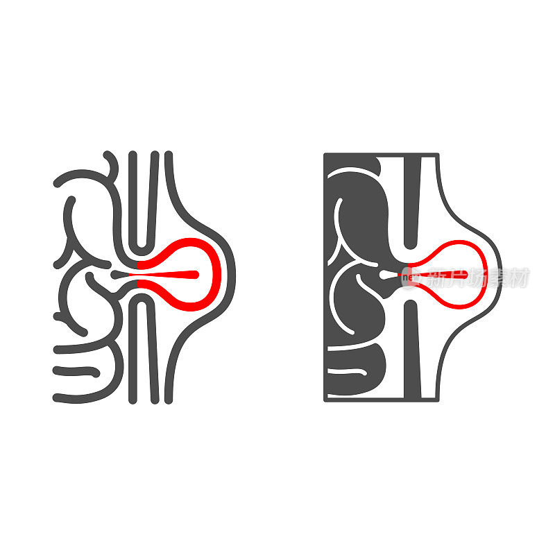 腹股沟疝线和固体图标，人类疾病概念，疝标志在白色背景，腹膜炎图标在轮廓风格的移动概念和网页设计。矢量图形。