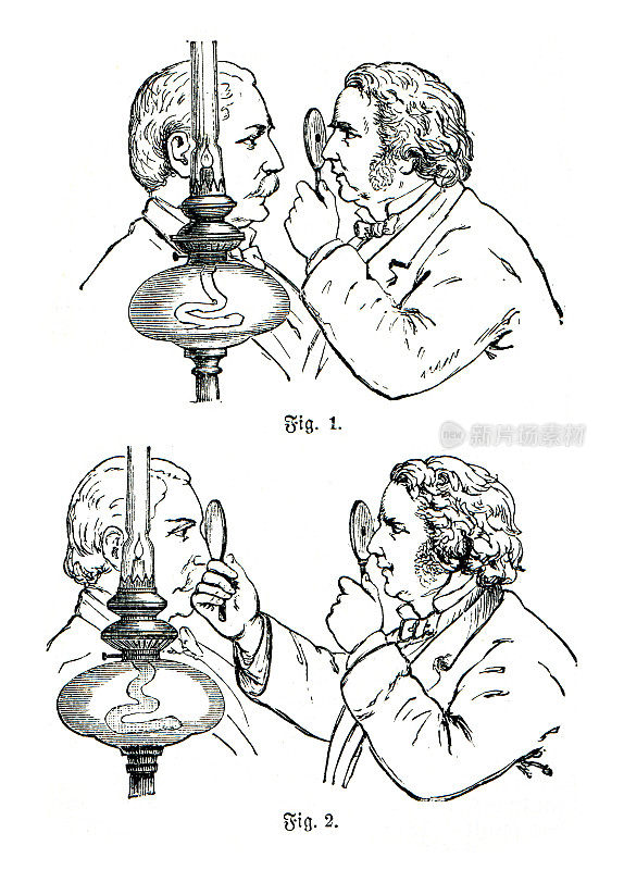 眼科医生检查病人的眼睛1898