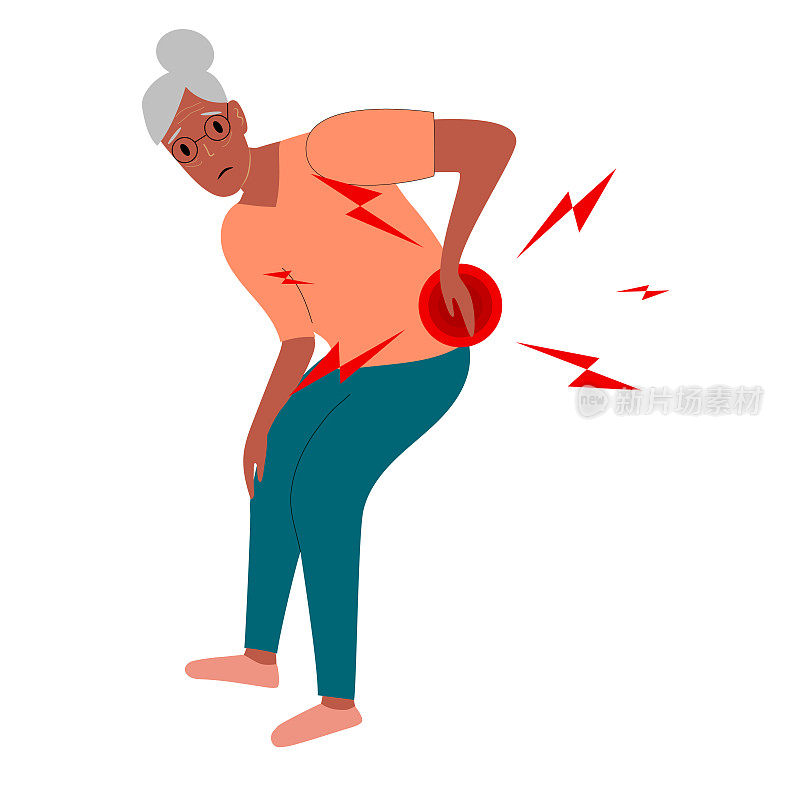 非裔美国老年妇女腰酸背痛和坐骨神经痛由椎间盘突出。医学上关于神经阻滞的图解使病人慢性背痛和瘫痪。矢量插图。