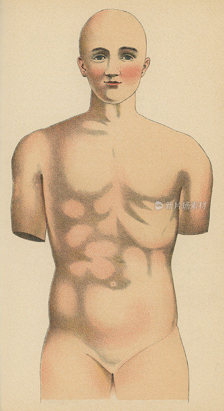 人体躯干的医学插图――19世纪