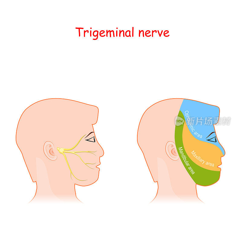 三叉神经及主要神经支配区域。头部神经学计划。