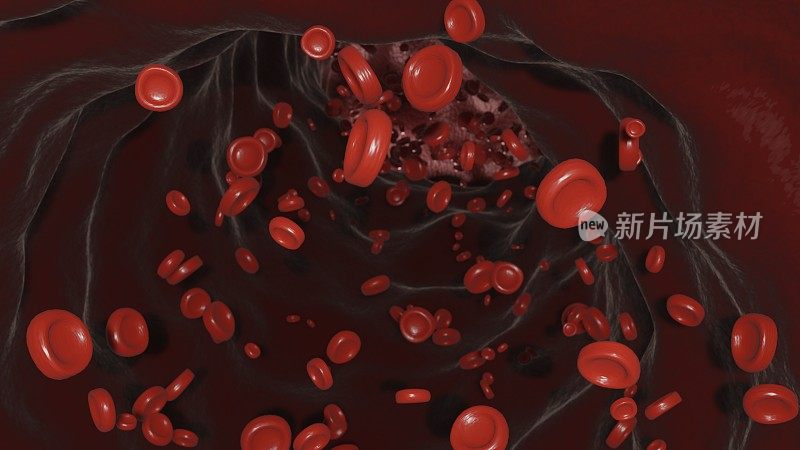 红细胞图