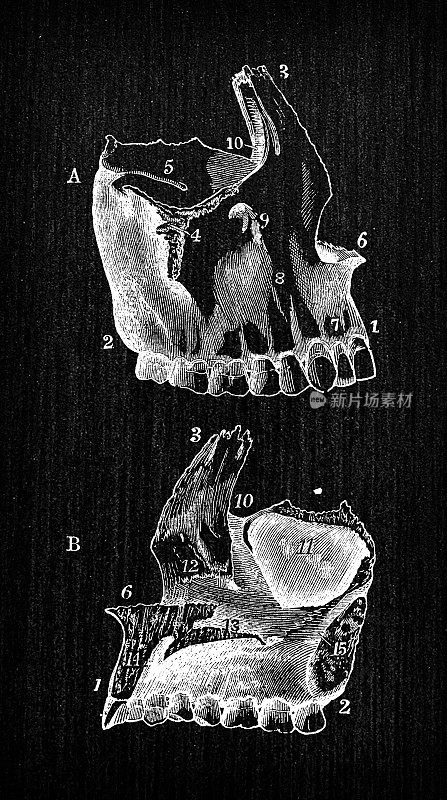 人体解剖学古董插图:颅骨上颌骨
