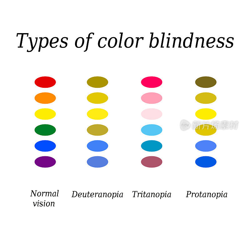 色盲的类型。眼睛的颜色感知。矢量插图在孤立的背景